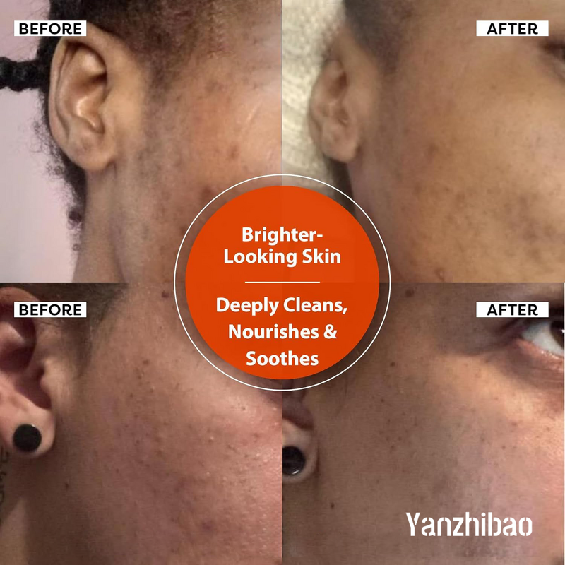 Facial Cleanser Manufacturer - Vitamin C Brightening with Rosehip Oil for Deep Clean Radiant Healthy Skin