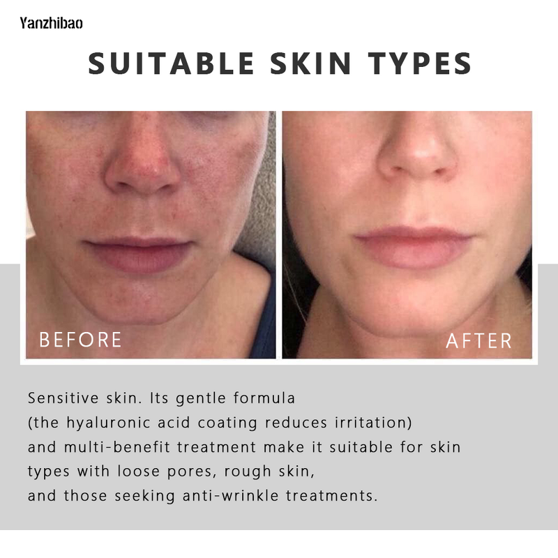 Facial Serum Manufacturer - Hyaluronic Acid with EGF Adenosine 1.69 Fl.oz/50ml Korean OEM Skincare