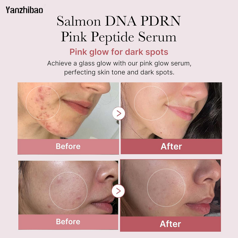 Face Serum Manufacturer - Salmon DNA + PDRN Pink Peptide & Niacinamide for Moisturizing Brightening
