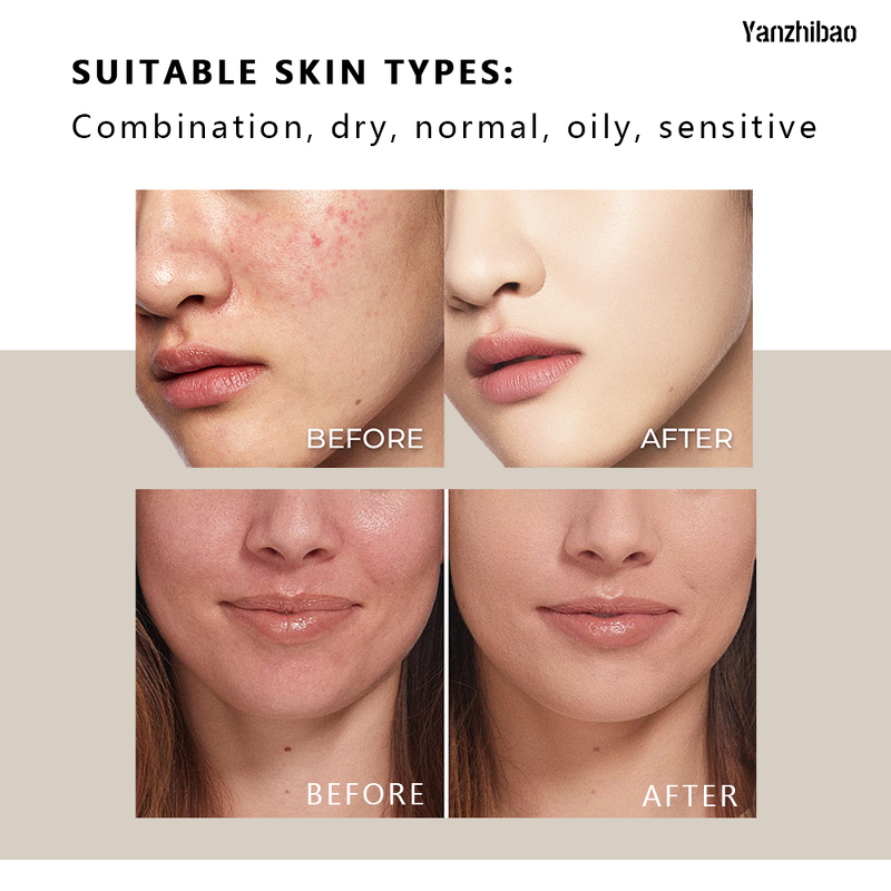 Facial Serum Manufacturer - Centella Asiatica with Organic Witch Hazel for Hydration 100ml