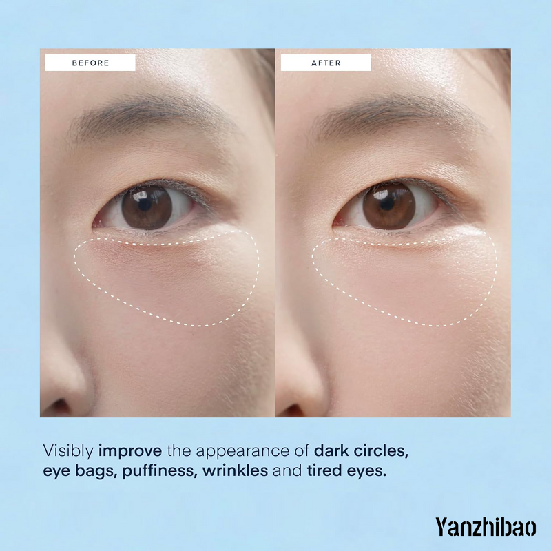 Eye Mask Manufacturer - OEM Under Eye Patches for Dark Circles Brightening Hydrating Anti-Wrinkle Cooling