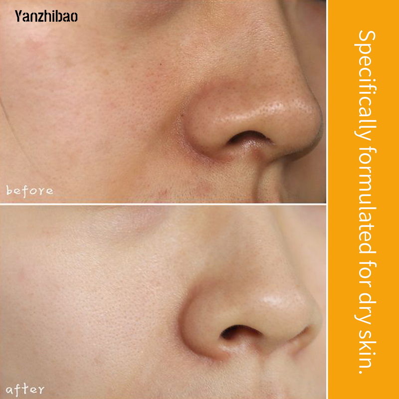 Body Scrub Manufacturer - OEM Vitamin C Shea Butter for Ultra Hydrating Nourishing Exfoliation