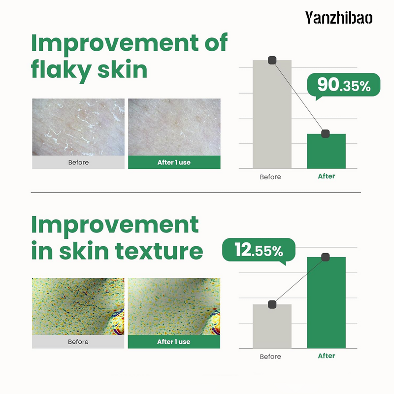 Exfoliating Gel Manufacturer - OEM Korean Skin Care PHA Glow 1.69oz 10% Fruit-Based for Pores Radiant Glass Skin