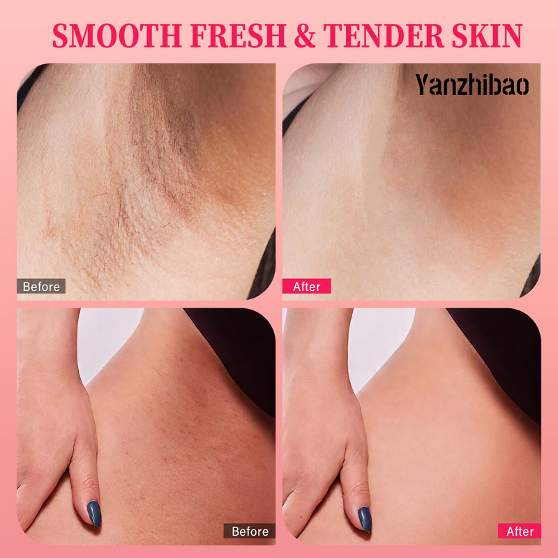 Body Scrub Manufacturer - OEM Bikini Area with 10% AHAs BHA Vitamin C for Ingrown Hair Dark Spots