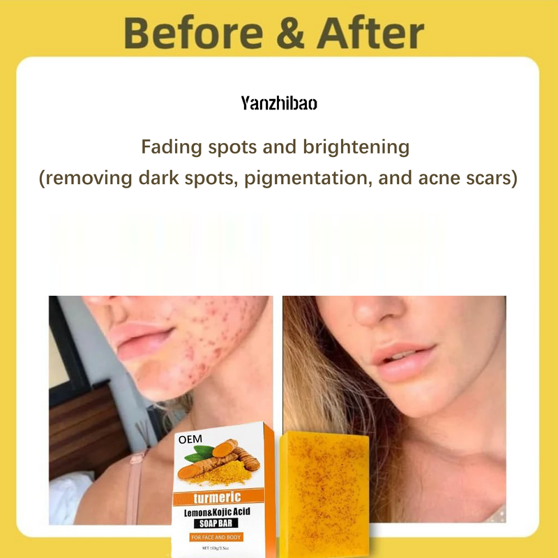 Soap Manufacturer - OEM Kojic Acid Turmeric for Dark Spot Removal Lightening Vitamin C Retinol Shea Butter Lemon Oil