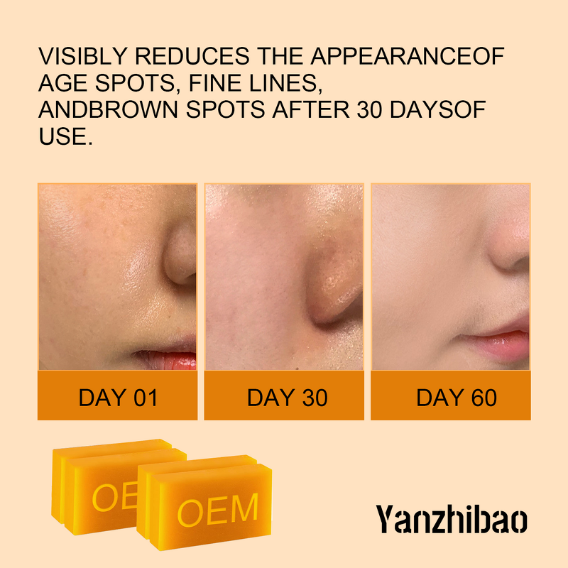 Soap Manufacturer - OEM Kojic Acid Bars 1.7oz for Dark Spot Removal Vitamin C Retinol Collagen Turmeric