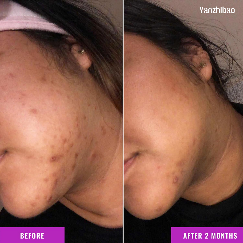 Facial Serum Manufacturer - Discoloration Correcting with Tranexamic Acid & Niacinamide for Dark Spots