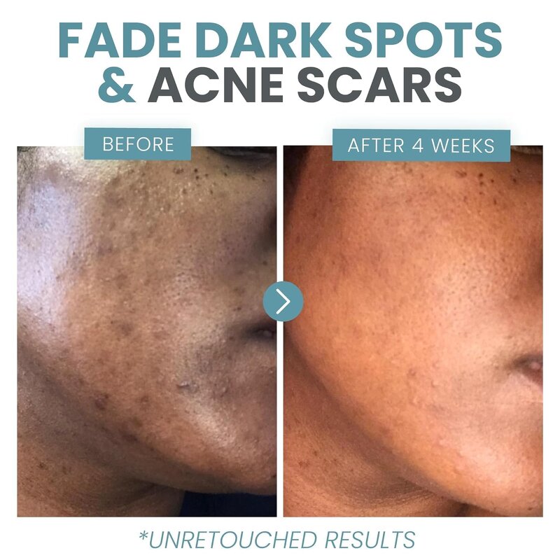 Face Serum Manufacturer - Vitamin C + Hyaluronic Acid 1oz for Dull Uneven Textured Skin Brightening Anti-Aging