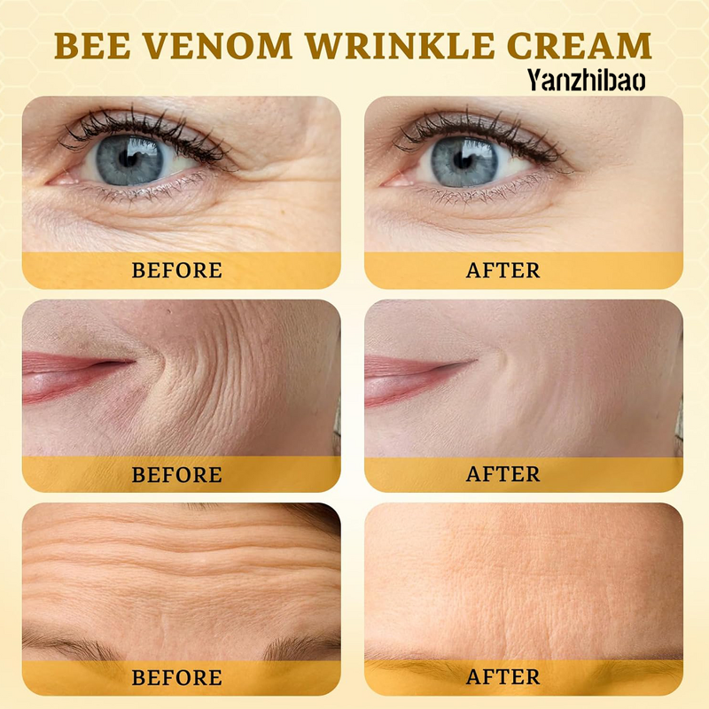 Face Cream Manufacturer - Bee Venom Comprehensive for Wrinkle Care Face Lift Firming Blemishes Reduction