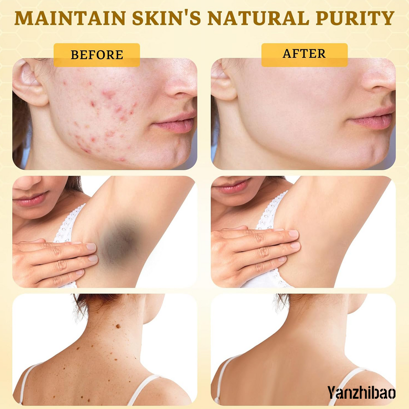 Face Cream Manufacturer - Bee Venom Comprehensive for Wrinkle Care Face Lift Firming Blemishes Reduction