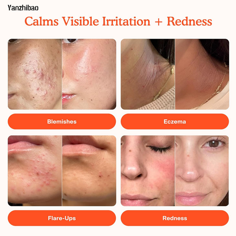 Spray Manufacturer - Daily 4 FL Oz Toner Liquid for Sensitive Skin Redness Reduction Hypochlorous Acid