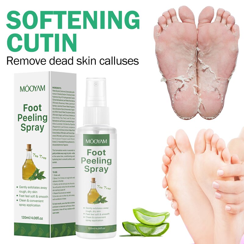 Foot Spray Manufacturer - Tea Tree Peeling for Dead Skin Removal 120ml OEM Wholesale Private Label MOOYAM