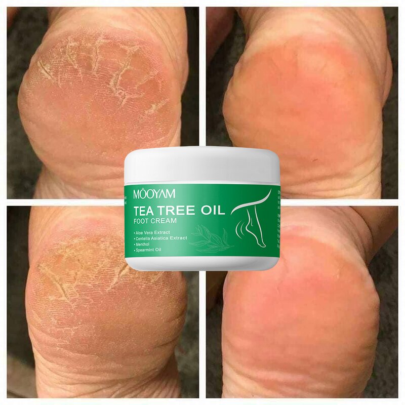 Foot Cream Manufacturer - Tea Tree Oil for Dry Skin Calluses Softening 250g OEM Wholesale Private Label MOOYAM