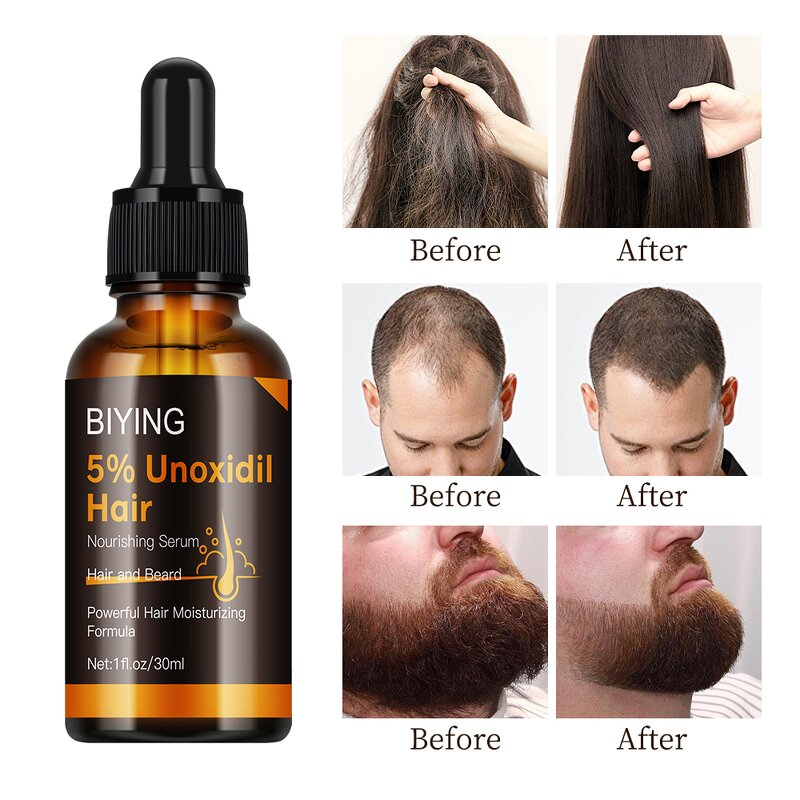 Hair Care Serum Manufacturer - 5% Unoxidil for Beard Hair Moisturizing Smooth 30ml MOOYAM
