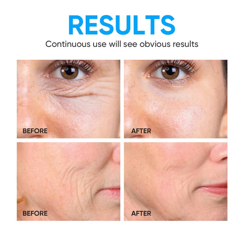 Face Lotion Manufacturer - Collagen Firming Hydrating Moisture Locking Private Label OEM MOOYAM