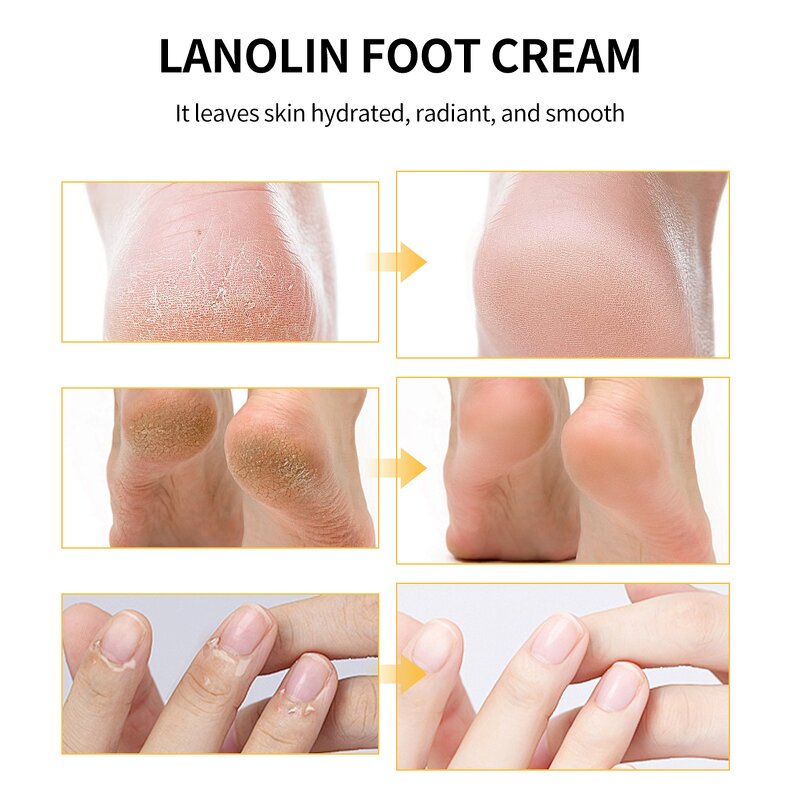 Foot Cream Manufacturer - Lanolin for Dry Skin Calluses Softening 40g OEM Wholesale MOOYAM