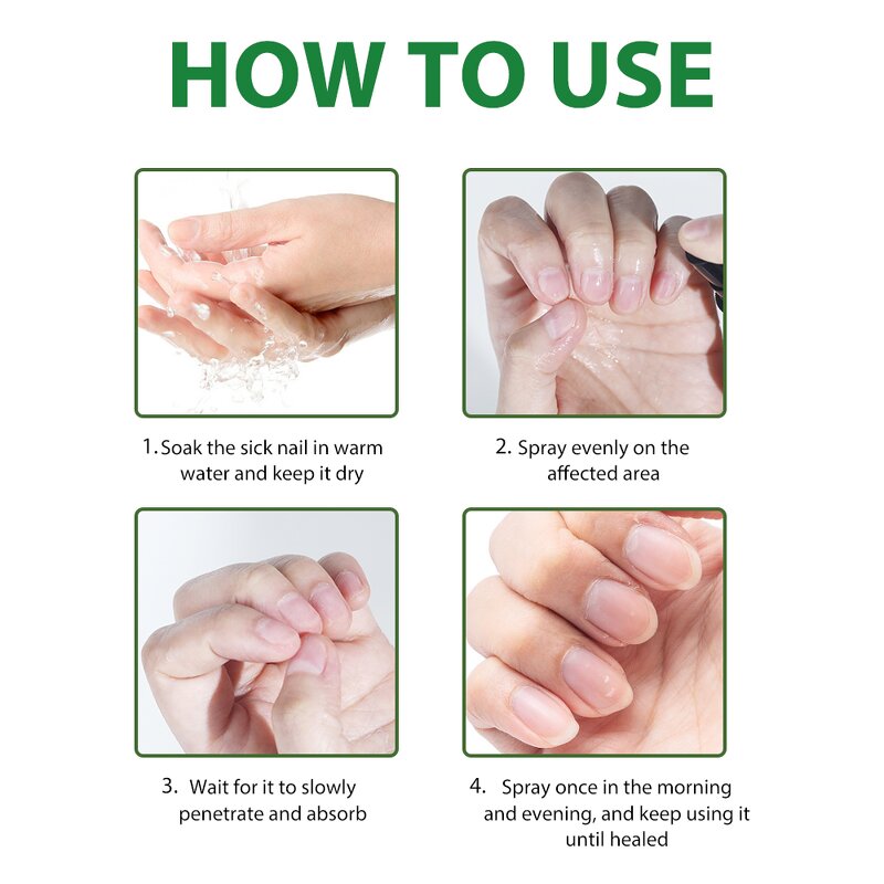 Nail Treatment Spray Manufacturer - 7 Days Nail Fungus for Bacteria Repair 30ml Customized OEM MOOYAM