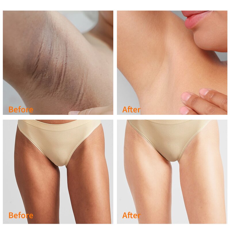 Body Scrub Manufacturer - Mango Bikini Scrub for Inner Thigh Nourishing Whitening MOOYAM