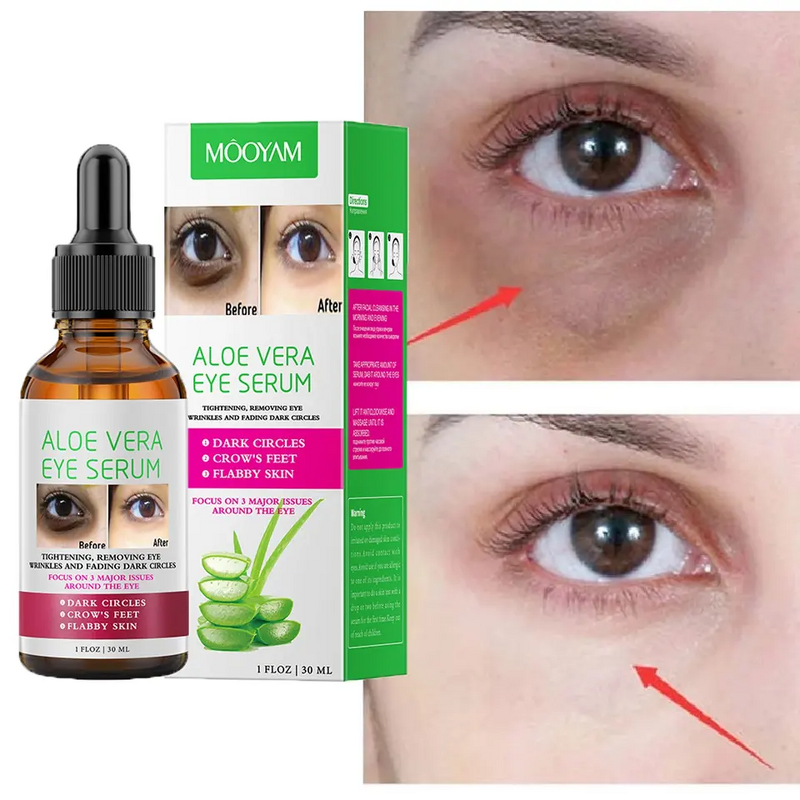 Eye Serum Manufacturer - Fine Line Eye Bags Lift Firming Anti-Aging Aloe Vera Moisturizer MOOYAM