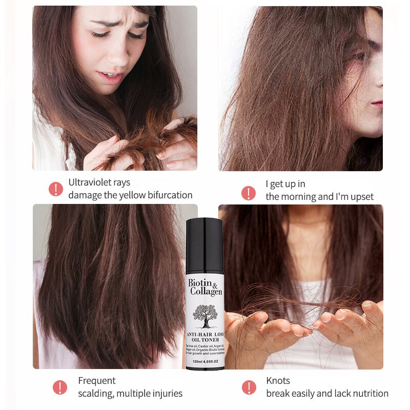 Hair Growth Oil Manufacturer - Biotin Collagen 120ml - Ginger Oil Anti Loss, Awakens Follicles, Strengthening Hair Root