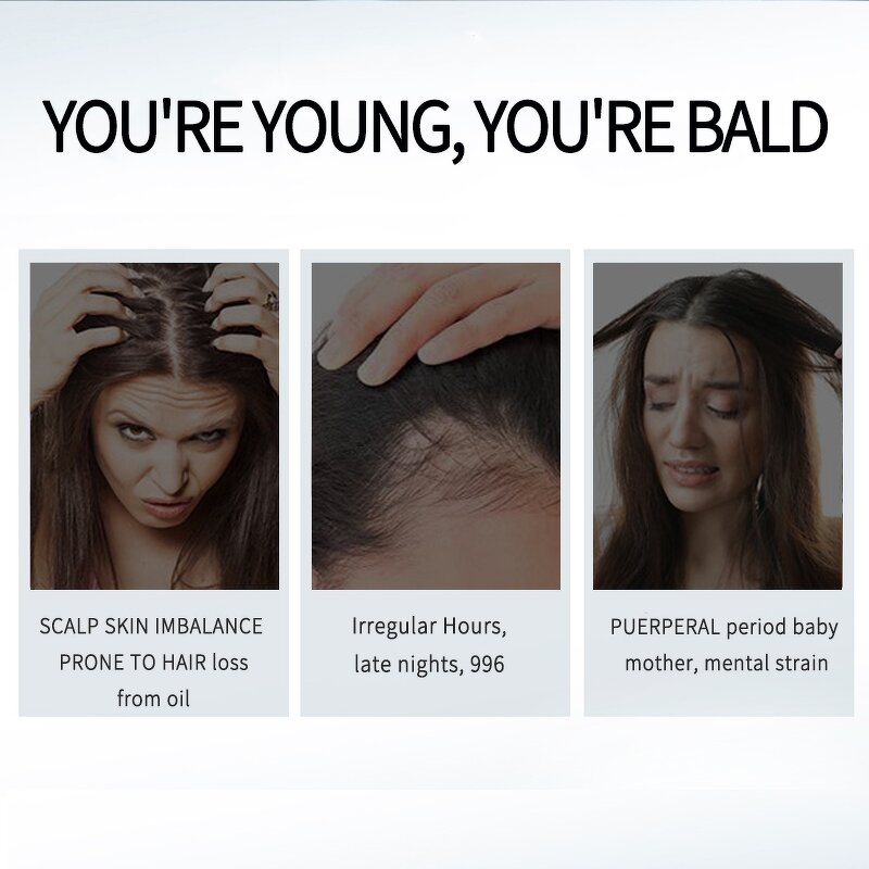 Hair Growth Spray Manufacturer - New Biotin 100ml - Organic Toner Lotion Serum for Dry Hair, OEM/ODM, Wholesale