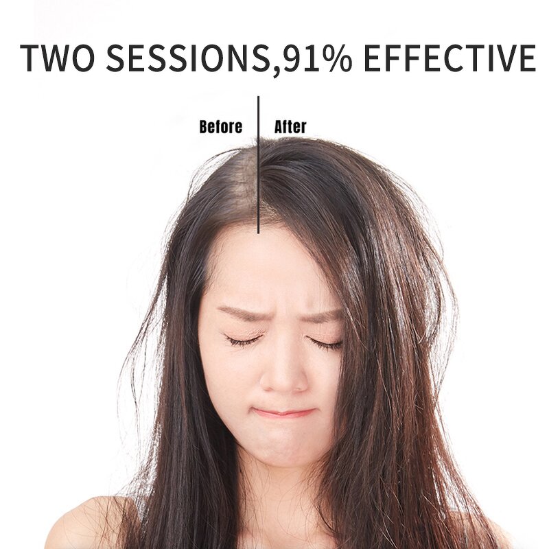 Hair Growth Spray Manufacturer - New Biotin 100ml - Organic Toner Lotion Serum for Dry Hair, OEM/ODM, Wholesale