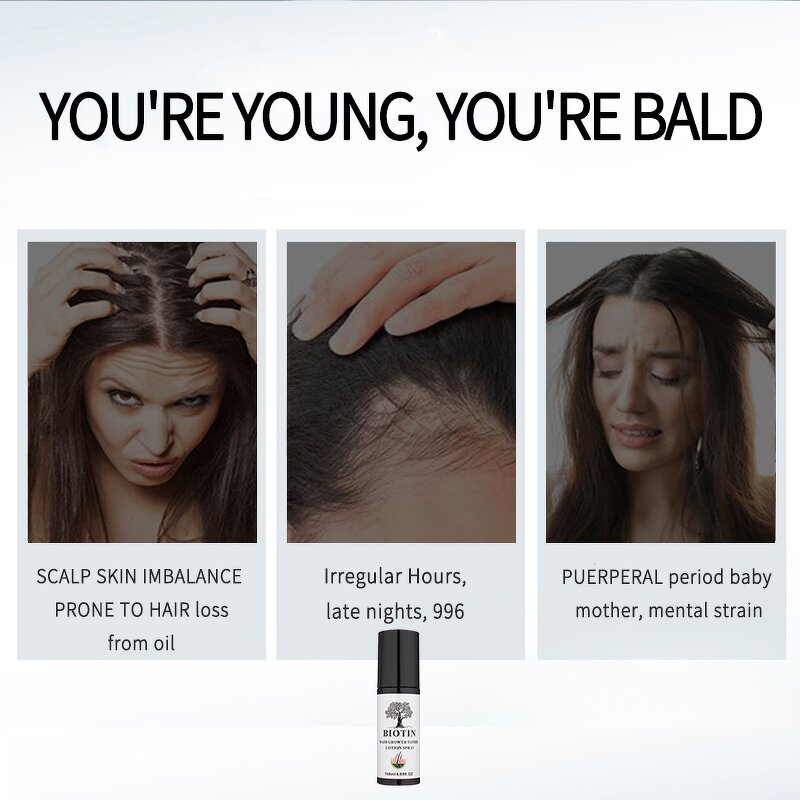 Anti-hair Loss Spray Manufacturer - Fast Growth Biotin 100ml - Ginger Rosemary Extract, Strengthening Anti-baldness Care, Unisex