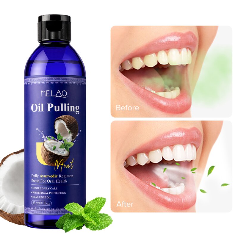Mouthwash Manufacturer - Fight Bad Breath Deep Cleaning Whitening Disposable Custom Logo Oral Care