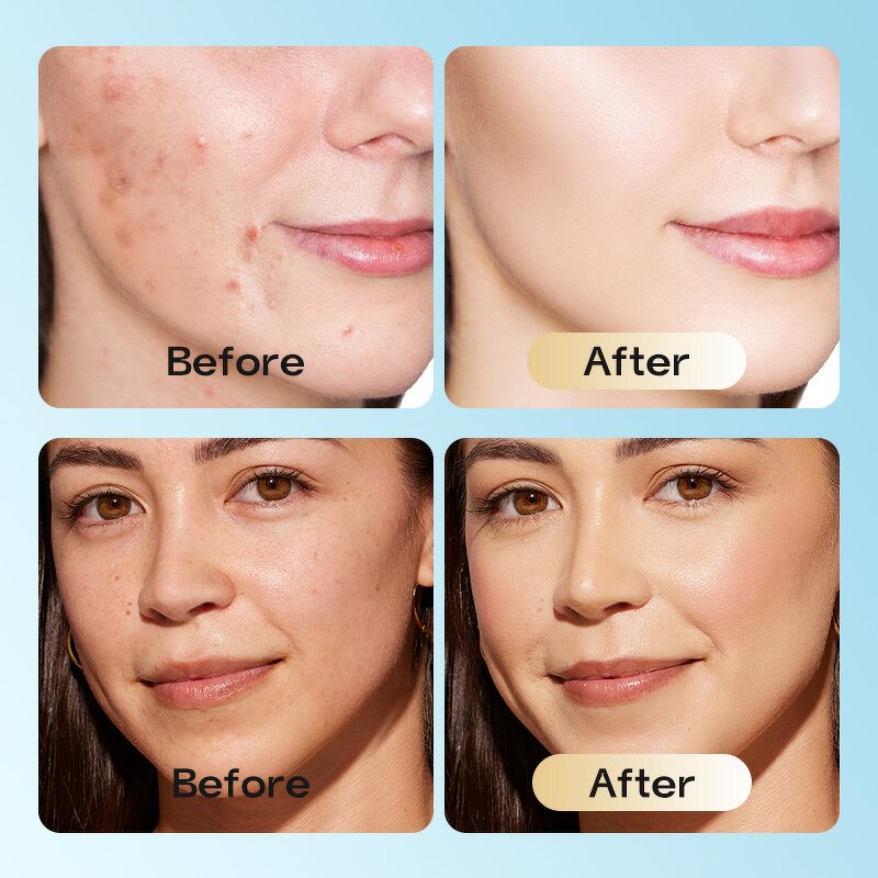 Facial Oil Manufacturer - 100% Pure Natural Moisturizing Cold Pressed Rosehip Oil Organic Skincare