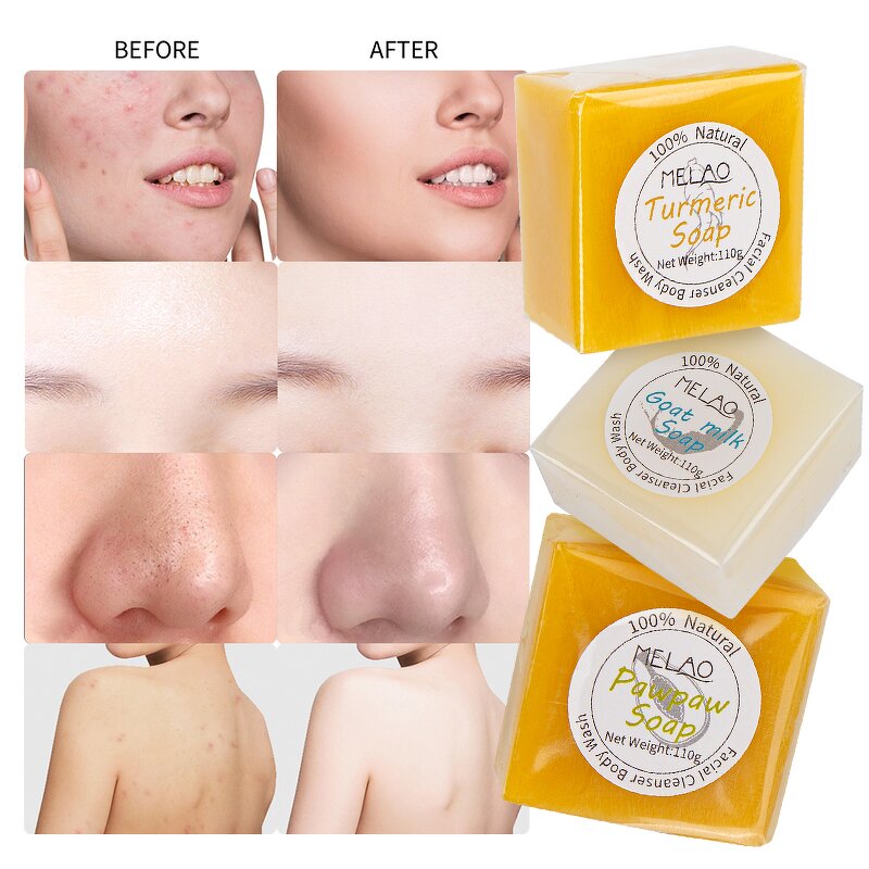 Soap Manufacturer - Turmeric Exfoliating Whitening Korean Skin Care Anti-Aging Brightening Formula
