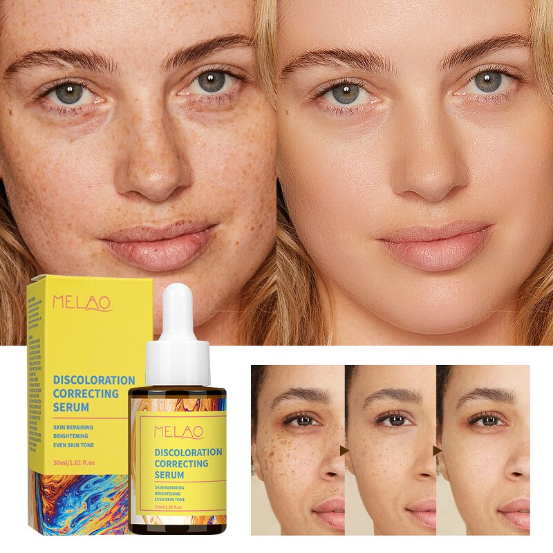 Correcting Serum Manufacturer - Anti-Aging Lift Brightening Hyaluronic Acid Vitamin C E Collagen Formula