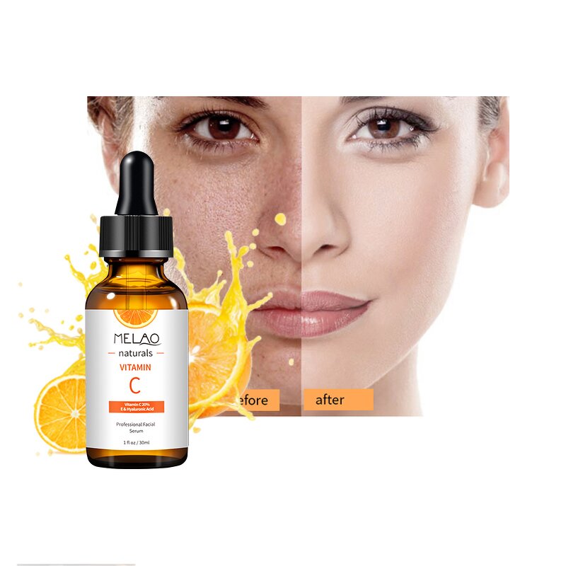 Hair Treatment Manufacturer - Private Label Natural Bulk Organic Vegan Hair Growth Boosting Oil Wholesale