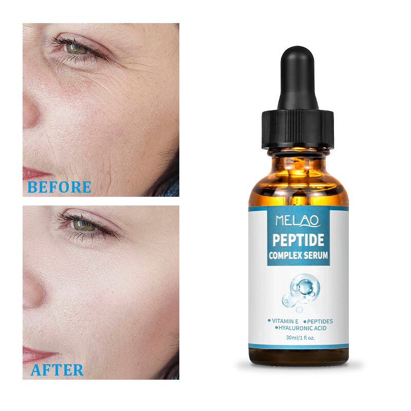 Face Serum Manufacturer - Oily Acne Prone Peeling Solution Salicylic Acid Acne Treatment Scar Serum