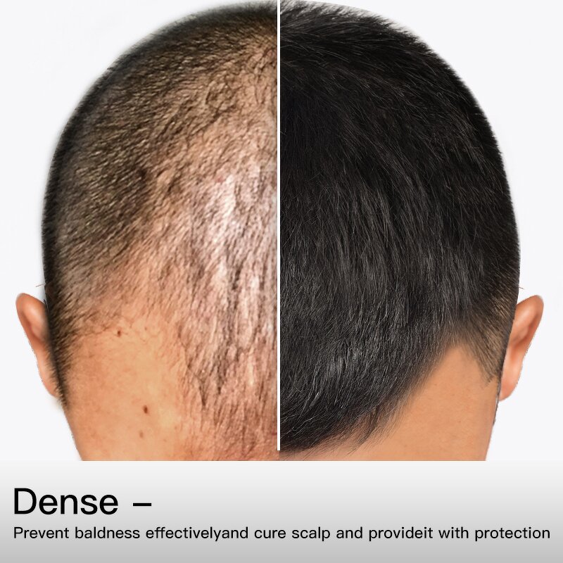 Hair Oil Manufacturer - MELAO Private Label Organic Hair Growth Serum Natural Black Hair Formula