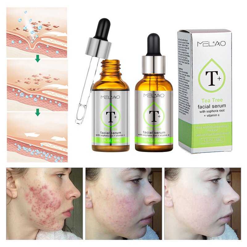 Face Serum Manufacturer - Custom Natural Dark Spot Whitening Anti-Aging Collagen Corrector Serum