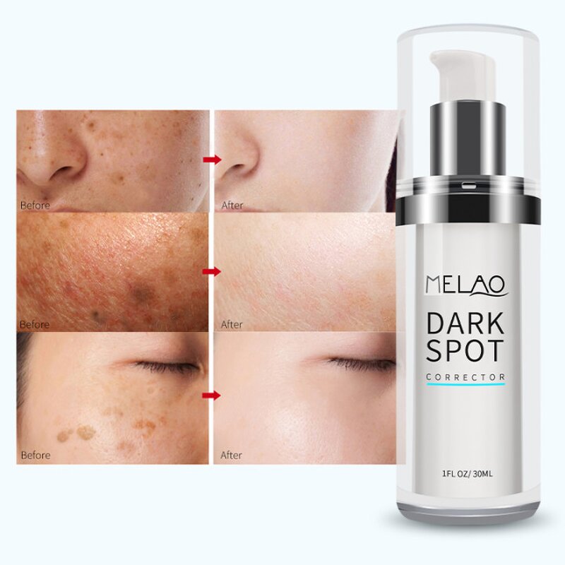 Face Serum Manufacturer - Natural Organic Acne Spot Pore Minimize Anti-Acne Salicylic Acid Formula
