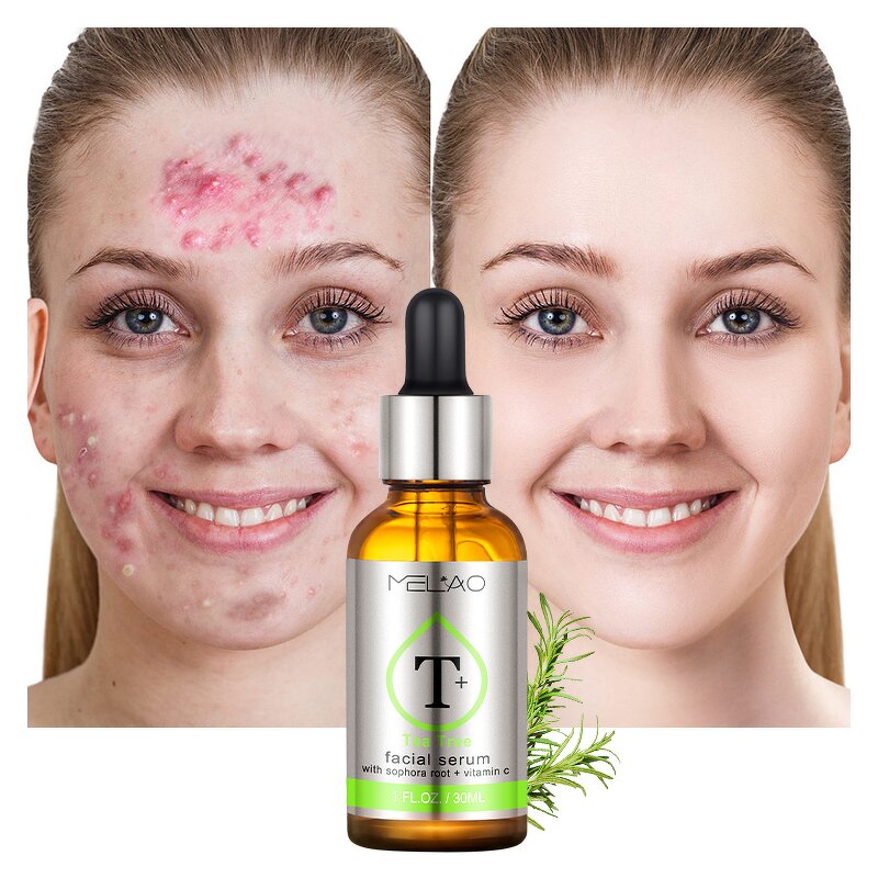 Face Serum Manufacturer - Custom Natural Dark Spot Whitening Anti-Aging Collagen Corrector Serum