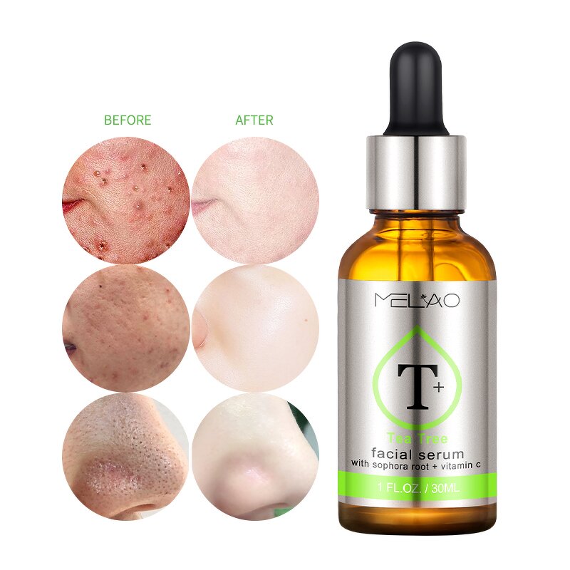 Face Serum Manufacturer - Custom Natural Dark Spot Whitening Anti-Aging Collagen Corrector Serum