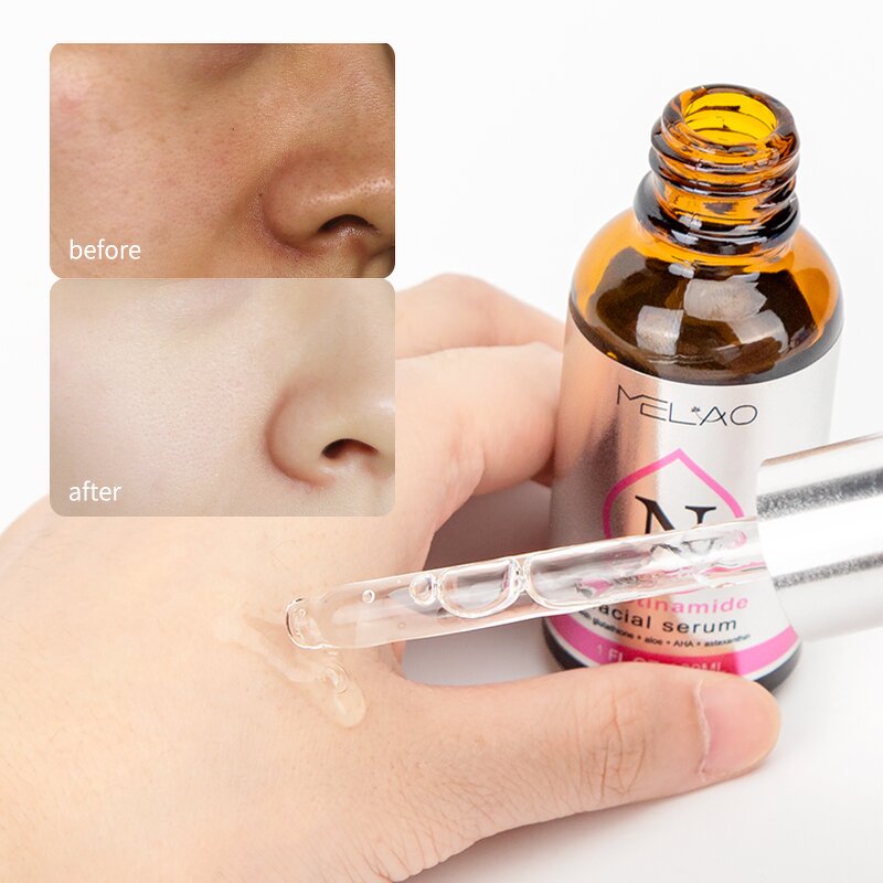 Face Serum Manufacturer - MELAO Anti-Redness Brightening Tea Tree Oil Dry Skin Moisturizing Formula