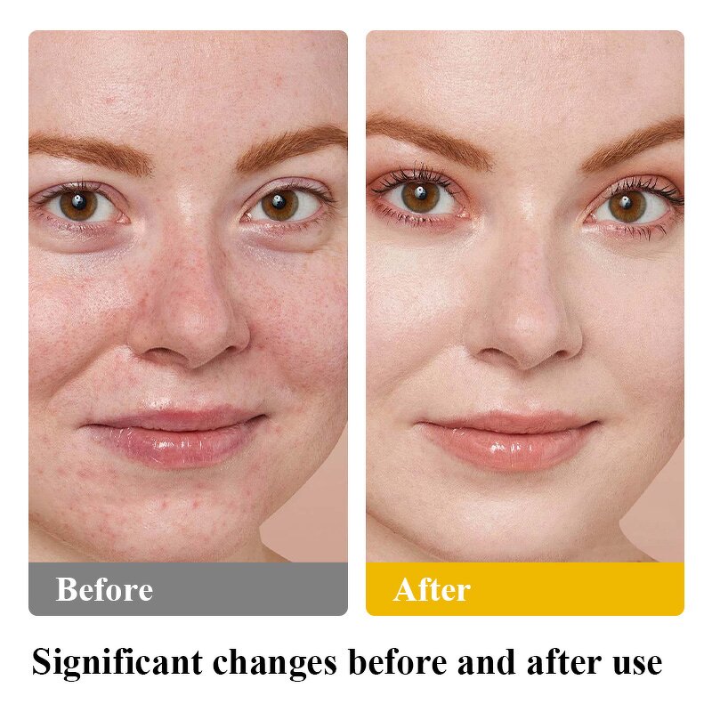 Body Lotion Manufacturer - Natural Facial Private Label Korean Skincare Vitamins Beef Tallow Balm