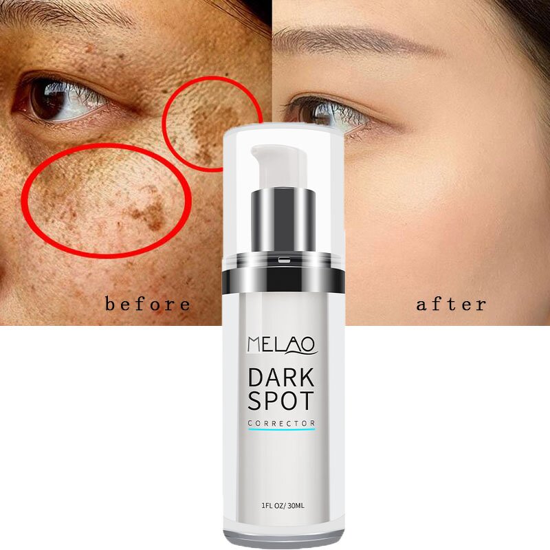 Face Serum Manufacturer - Natural Organic Acne Spot Pore Minimize Anti-Acne Salicylic Acid Formula