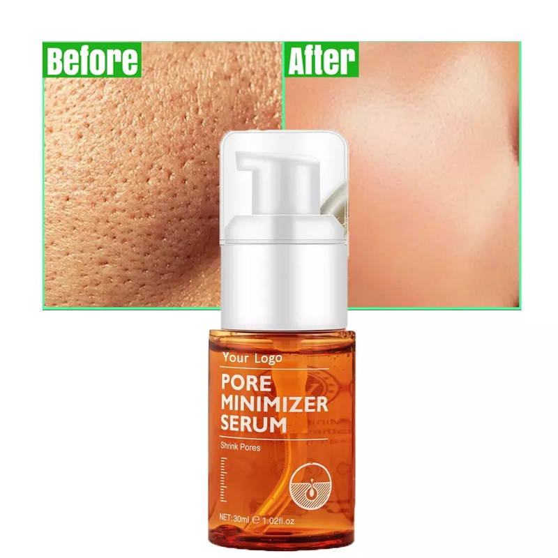 Face Serum Manufacturer - Oily Acne Prone Peeling Solution Salicylic Acid Acne Treatment Scar Serum
