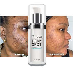 Face Serum Manufacturer - Natural Organic Acne Spot Pore Minimize Anti-Acne Salicylic Acid Formula