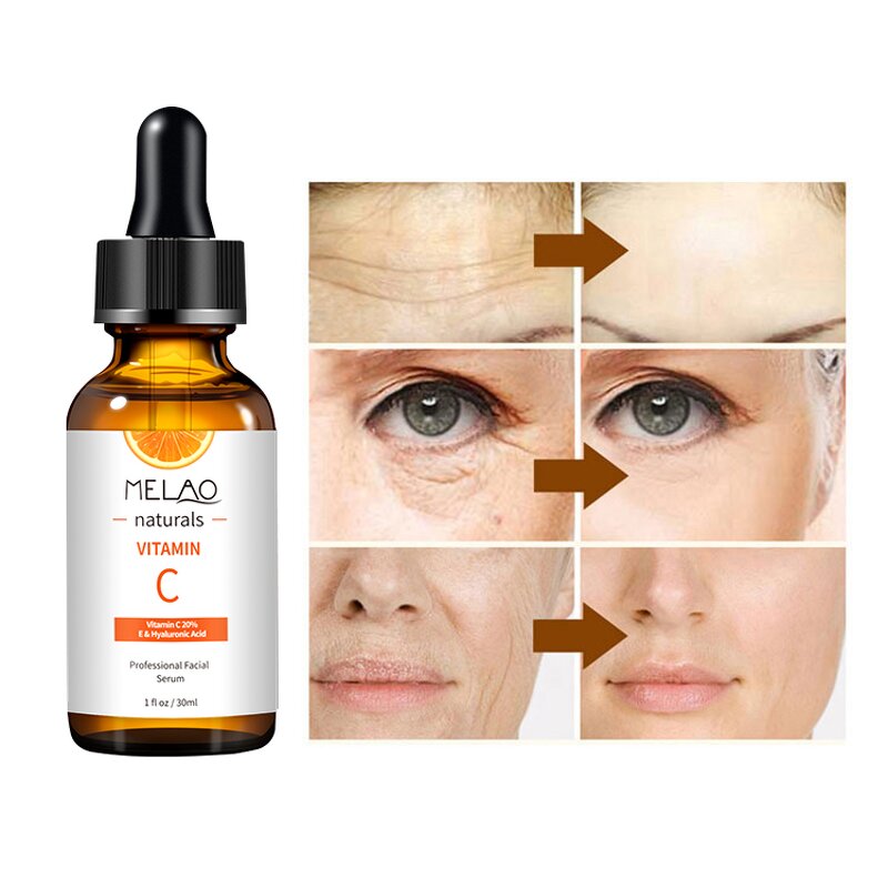 Hair Treatment Manufacturer - Private Label Natural Bulk Organic Vegan Hair Growth Boosting Oil Wholesale