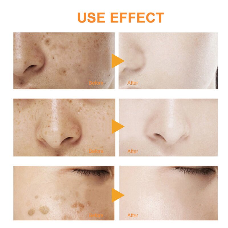 Face Toner Manufacturer - Wholesale Private Label Turmeric, Lightening Acne Remover, Soothes Dryness