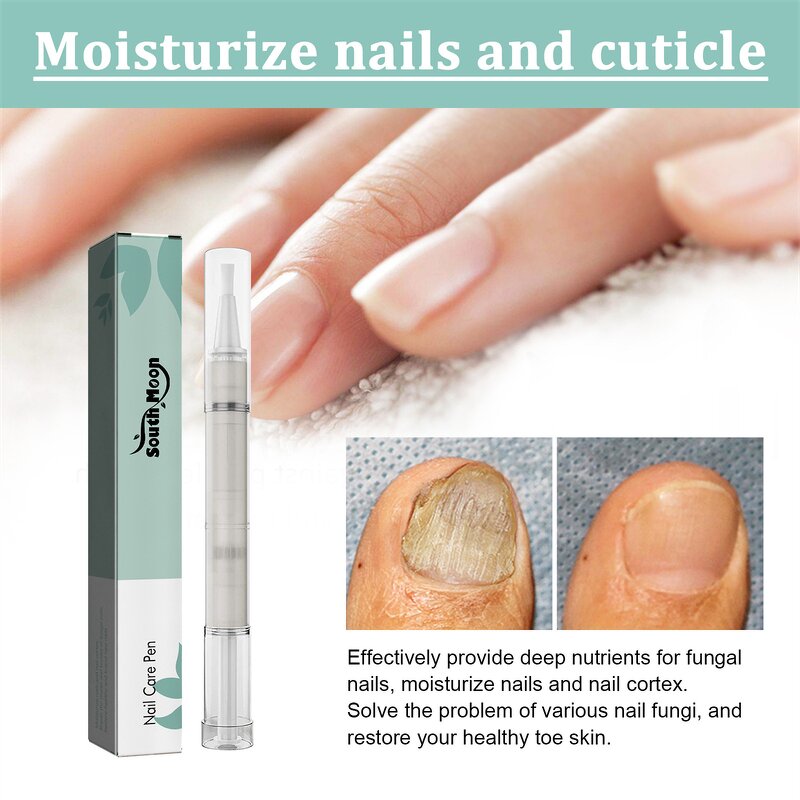 Nail Repair Pen Manufacturer - South Moon Thick Nail Onychomycosis Subungual Edema Fungal Infection Treatment