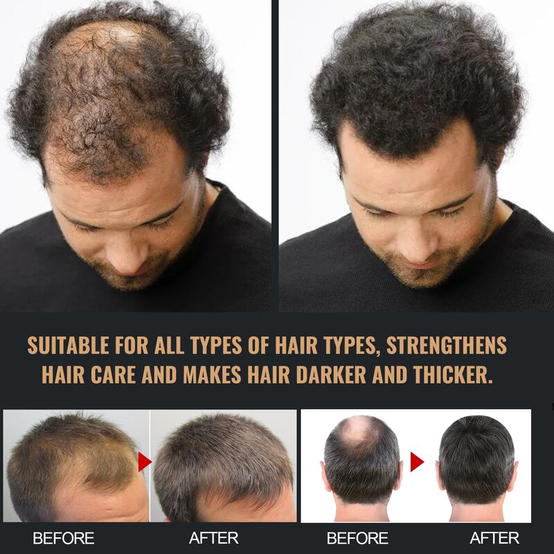 Hair Shampoo Manufacturer - Dense Hair Anti-set Hair Thick Fluffy Soft Strong Repair 100ml