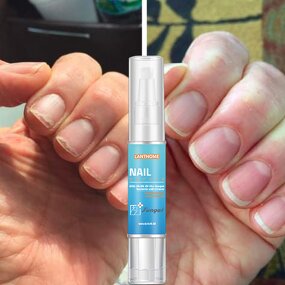 Nail Repair Pen Manufacturer - Lanthome Wholesale 4ml Herbal Anti Fungal Toenail Treatment Pen for Care