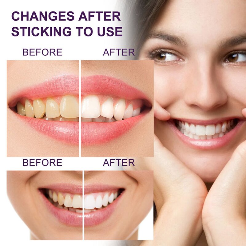 Tooth Repair Gel Manufacturer - Eelhoe Tooth Color Repair Teeth Stain Remover Agent Teeth Whitening Clean Toothpaste