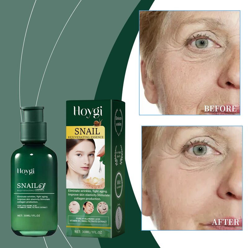 Hyaluronic Acid Essence Manufacturer - Snail Hyaluronic Acid Female Face Skin Care Treatments